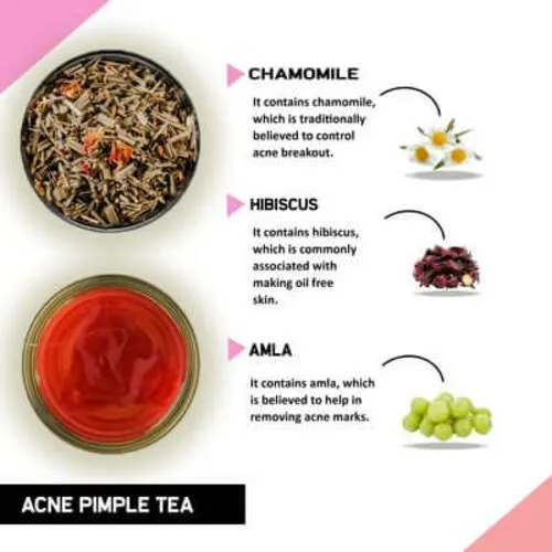 Acne Tea - Helps in Pimples, Cysts, Pustules & Nodules
