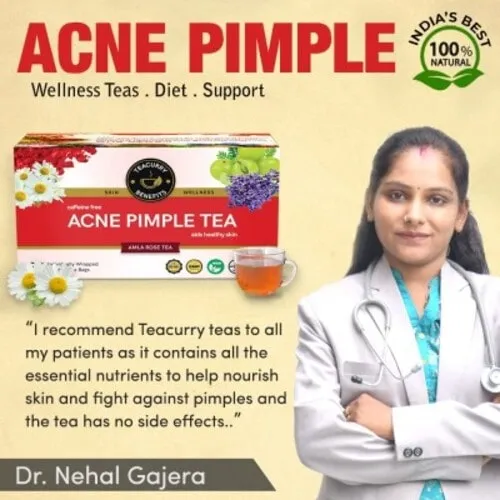 Acne Tea - Helps in Pimples, Cysts, Pustules & Nodules