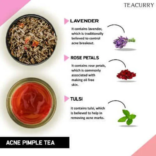 Acne Tea - Helps in Pimples, Cysts, Pustules & Nodules