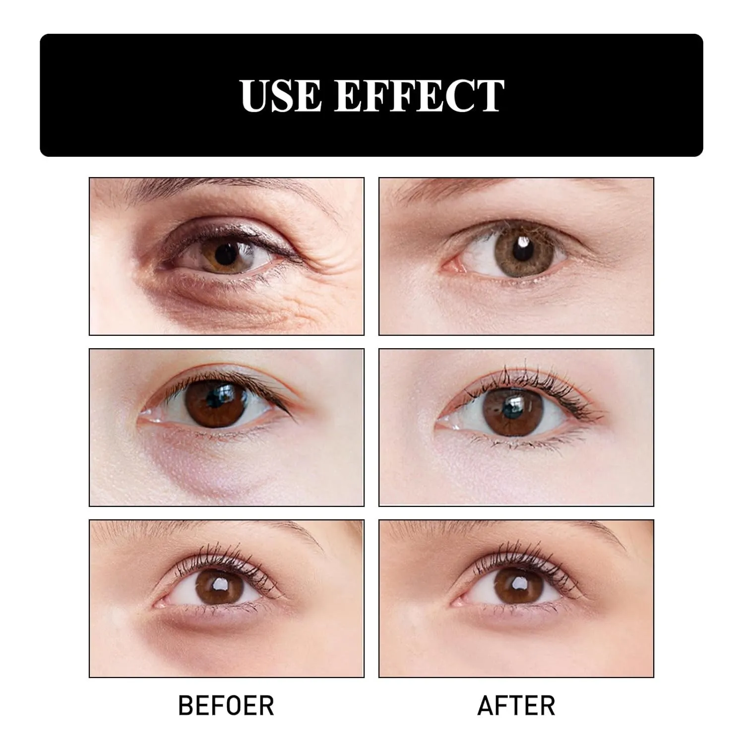 Gentian Anti-Wrinkle Eye Cream,20g Gentian Eye Cream,Hankylin Gentian Eye Cream,Gentian Eye Cream For Eye Bags,Gentian Anti Wrinkle Eye Cream,Firming (3PC)